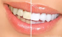 Медицинский центр Одонт на улице Зои Космодемьянской фотография 8