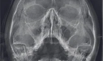 Независимый центр рентгенодиагностики Пикассо на Торфяной дороге фотография 5