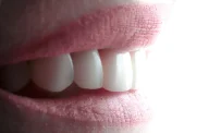 Авторская стоматология с онлайн-консультацией iP Clinic фотография 12