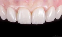 Авторская стоматология с онлайн-консультацией iP Clinic фотография 9