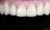 Авторская стоматология с онлайн-консультацией iP Clinic фотография 18
