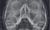 Независимый центр рентгенодиагностики Пикассо на проспекте Ветеранов фотография 6