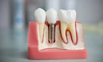 Стоматологическая клиника World Dent фотография 7
