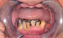 Стоматологическая клиника Зубы за 1 день фотография 6