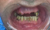 Стоматологическая клиника Зубы за 1 день фотография 7