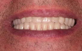 Стоматологическая клиника Зубы за 1 день фотография 3