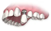 Стоматология "Мой Зубной" на проспекте Пятилеток фотография 7