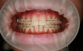 Клиника стоматологии и имплантации СтомЛайф фотография 2