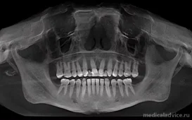 Стоматология Белозубофф фотография 3