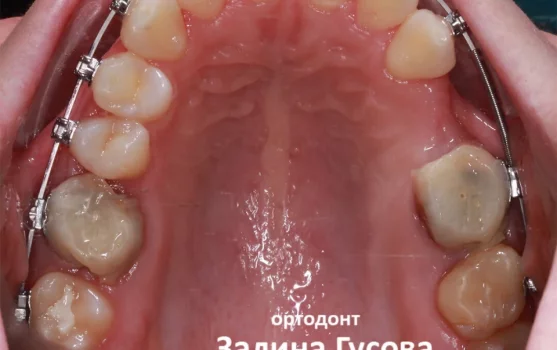Мир стоматологии на Кондратьевском проспекте фотография 1