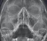 Независимый центр рентгенодиагностики Пикассо на Заневском проспекте фотография 2