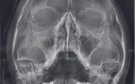 Независимый центр рентгенодиагностики Пикассо на Заневском проспекте фотография 2