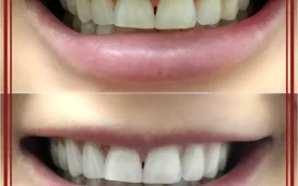Студия косметического экспресс-осветления зубов White&Smile фотография 3